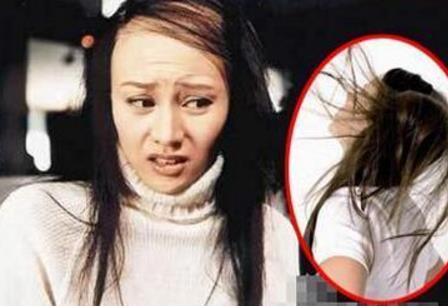 掉頭發(fā)吃什么