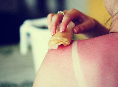 如何恢復(fù)曬后皮膚?曬后肌膚修復(fù)的方法