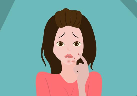 鼻子上長膿包痘多久會消?眉毛長痘痘怎么辦?