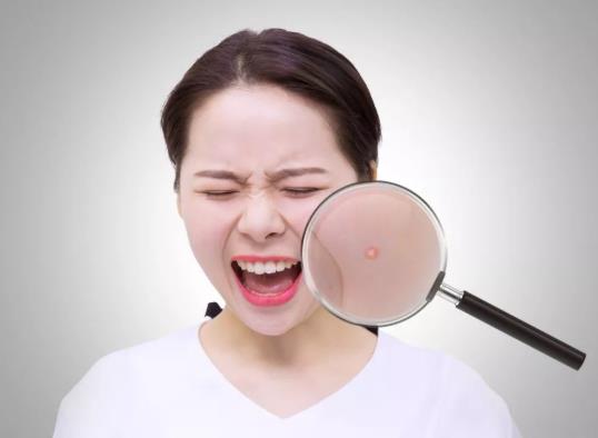 鼻子上長膿包型痘痘可以擠嗎?兩眉中間長痘怎么調理?