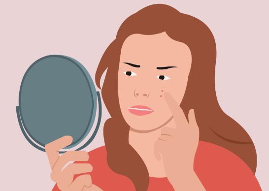 鼻子上長膿包型痘痘可以擠嗎?兩眉中間長痘怎么調理?