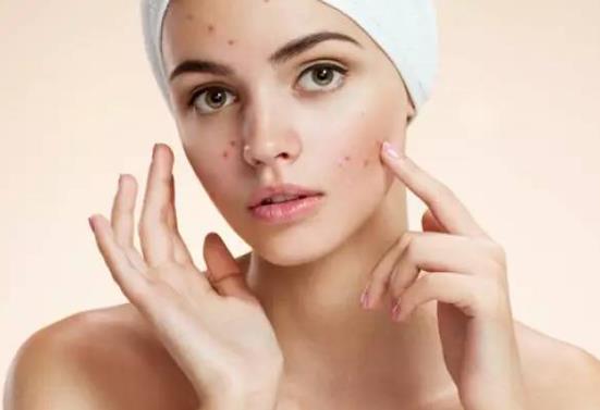 黑頭是怎么形成的?怎么區分黑頭閉口粉刺?