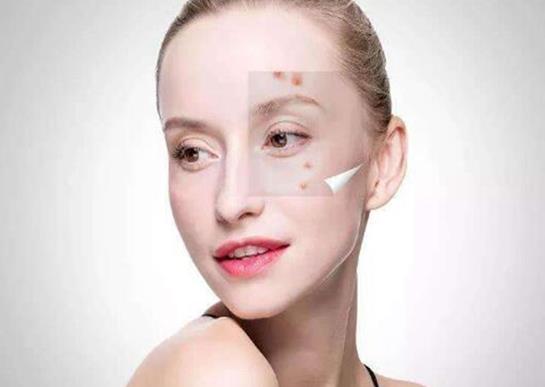 黑頭是怎么形成的?怎么區分黑頭閉口粉刺?