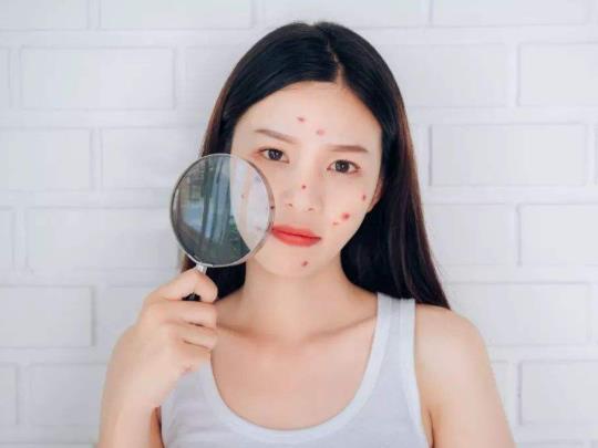 祛痘疫苗有沒有副作用?美容院里的祛痘疫苗是什么