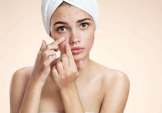 30歲了臉上還長痘痘是怎么回事?青春痘疫苗最新進展