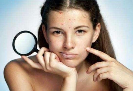 青春痘疫苗在哪里接種?青春痘疫苗2023年出來是真的嗎