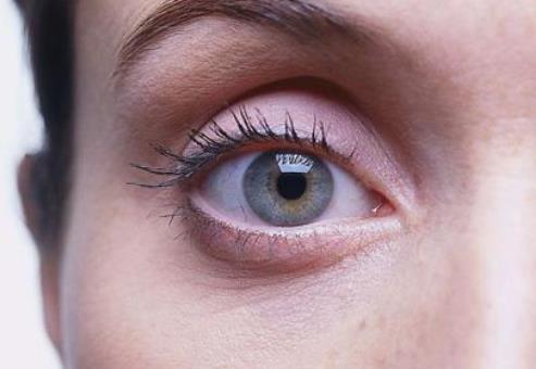 護(hù)眼:三步消除眼睛浮腫