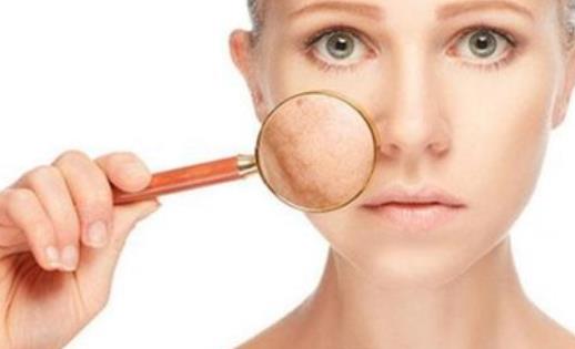 長痘以及痘痘惡化的原因 長痘痘了該怎么辦