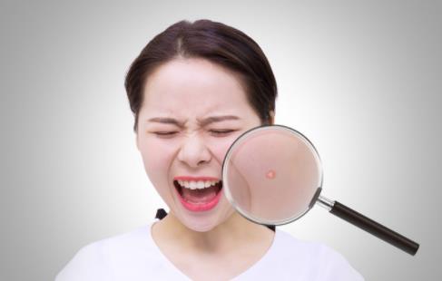 長痘以及痘痘惡化的原因 長痘痘了該怎么辦