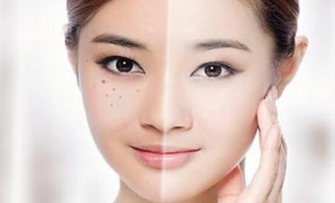 能夠有效預防青春痘的十大方法 有預防青春痘效果的食物