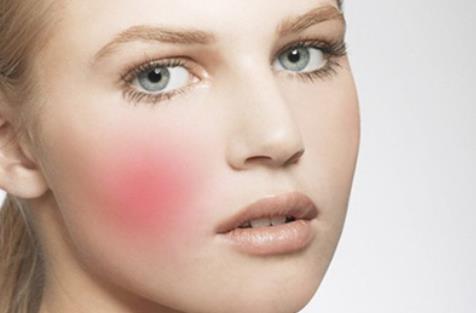 臉上出現紅血絲的皮膚該怎么護理呢 彩光嫩膚能去紅血絲嗎