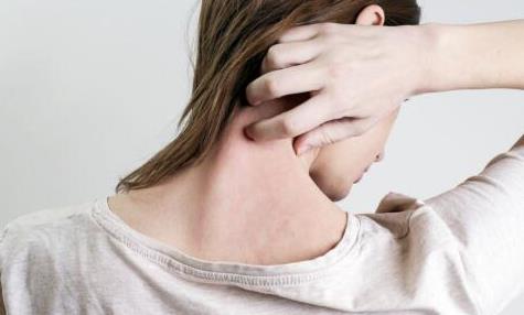 皮膚過敏是什么原因該怎么預防 皮膚過敏該怎么辦