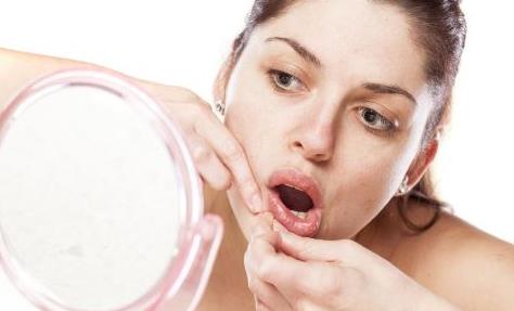 讓你快速祛痘的祛痘方法 關于痘痘你不知道的事