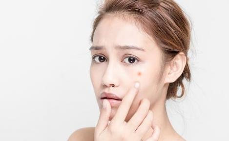 讓你快速祛痘的祛痘方法 關于痘痘你不知道的事