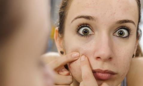 讓你快速祛痘的祛痘方法 關于痘痘你不知道的事