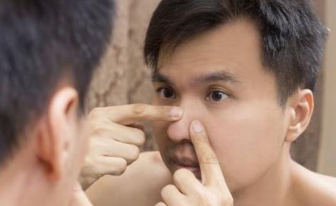 讓你快速祛痘的祛痘方法 關于痘痘你不知道的事