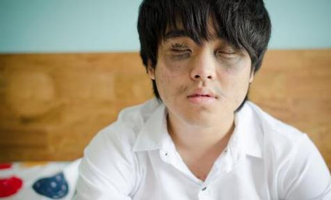 黑眼圈是怎么形成的呢 該怎么樣祛除黑眼圈