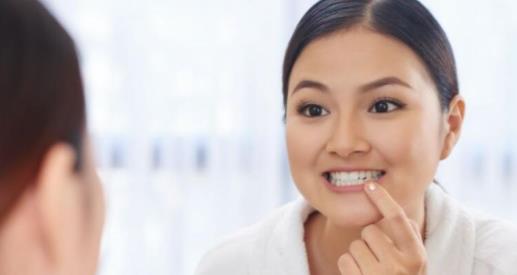 冷光美白牙齒能保持多久 冷光美白牙齒要注意什么事項