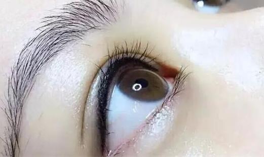 美瞳線淤青和暈色區(qū)別有哪些?紋美瞳線眼睛腫了怎么辦?