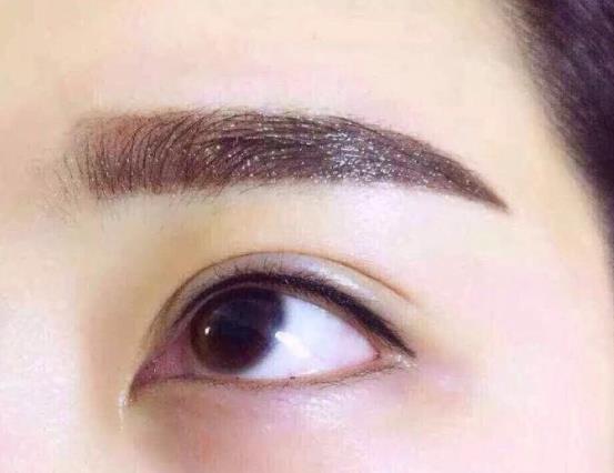 美瞳線淤青和暈色區(qū)別有哪些?紋美瞳線眼睛腫了怎么辦?