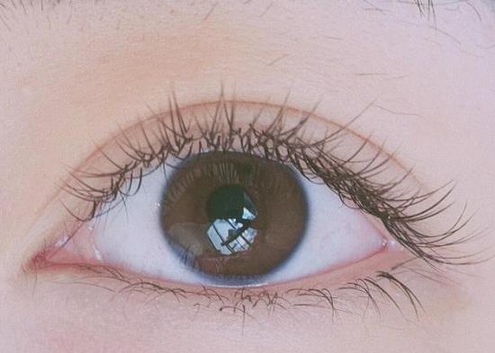 雙眼皮貼貼久了可能讓眼皮下垂?全切雙眼皮能管一輩子嗎