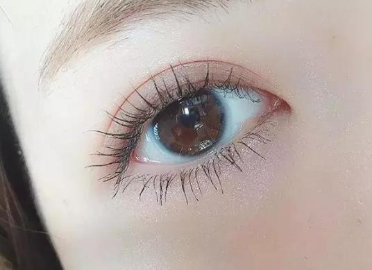 雙眼皮埋線不取會怎樣?做了雙眼皮吃醬油會留印嗎?