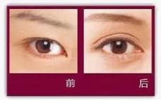 樂山經緯整形醫院技術好不好 為你重新定義美麗