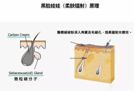 北京伊美爾紫竹醫(yī)院:光子嫩膚多久做一次