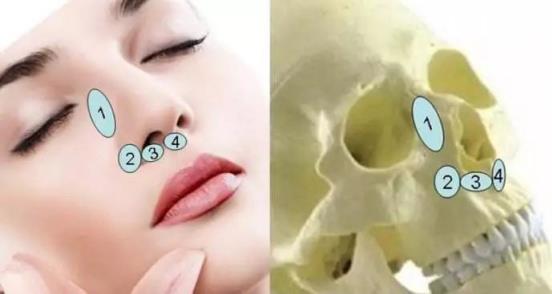 北京伊美爾醫療醫院:鼻唇溝是哪里