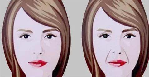 北京伊美爾醫療醫院:鼻唇溝是哪里