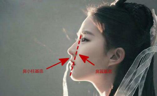 北京伊美爾醫療醫院:鼻唇溝是哪里