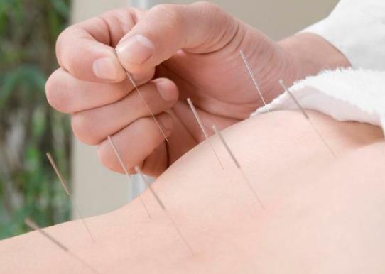 針灸減肥要堅持多久才行?針灸減肥幾次一個療程?