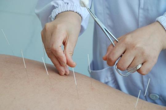 針灸減肥一個月能瘦多少斤?針灸減肥需要配合運動嗎?