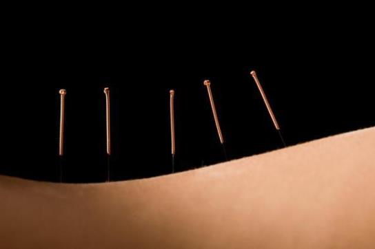 經(jīng)期可以針灸減肥嗎?針灸減肥會(huì)影響例假嗎?