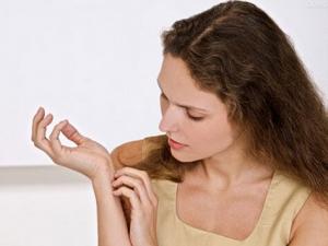 蚊蟲叮咬紅腫怎么辦?蚊蟲叮咬紅腫怎么止癢?