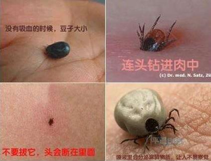 頭上長虱子怎么辦?虱子怎么去除?去虱子和虱子卵的有效方法