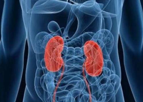 得了腎結石怎么辦?腎結石需要注意什么?患腎結石的原因