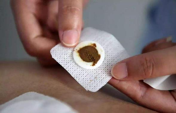 三伏貼每個人貼的中藥都一樣嗎?三伏貼貼的位置在哪里?