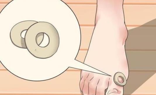 ?為什么會長雞眼?長了雞眼怎么辦?