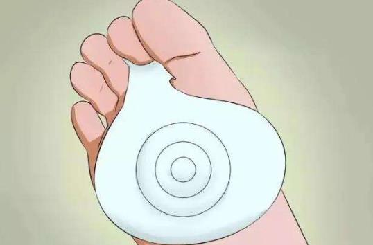 雞眼是什么?雞眼形成的原因有哪些?