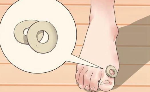 ?患了雞眼怎么辦?雞眼怎么治療?