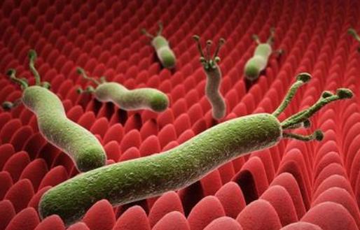 患十二指腸潰瘍的原因有哪些?怎么預(yù)防十二指腸潰瘍?