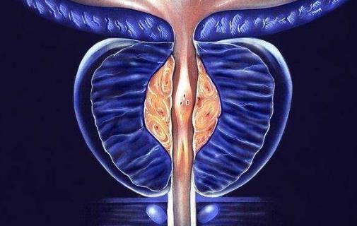 排尿困難會引起哪些并發癥?排尿困難有哪些危害?