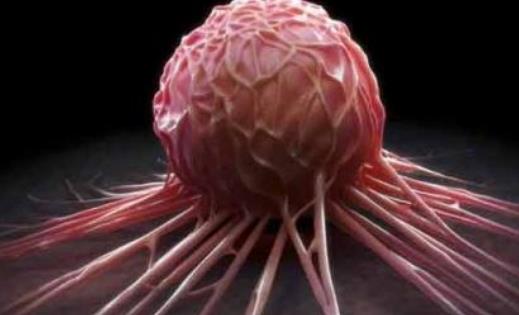 什么是小葉增生?小葉增生的人不要吃什么?