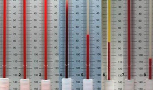 血常規與血沉有什么區別?血沉高的原因有哪些?
