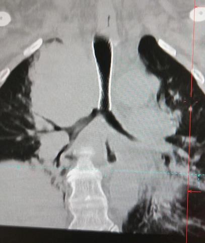 廣東哪家能看好腫瘤暨南大學附屬復大腫瘤醫院