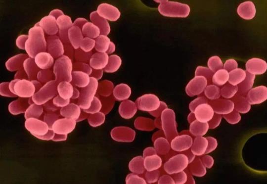 布病治療期間能同房嗎?得了布病為什么不能干活?