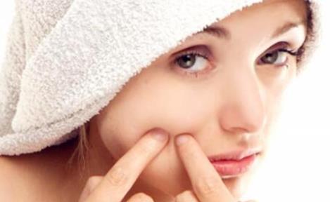 臉上長痘是因為熬夜嗎 為什么有的人熬夜不長痘痘