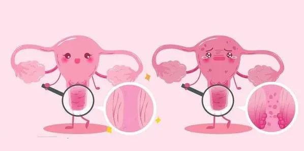 武漢仁愛醫院婦科:宮頸疾病,女人的紅顏禍“水”!!