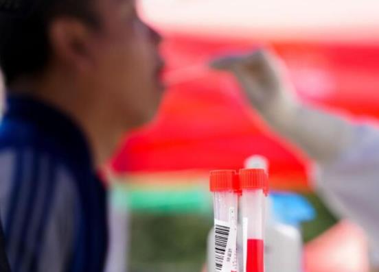 核酸檢測是住院的前一天做嗎?核酸檢測樣本應幾小時內送檢?